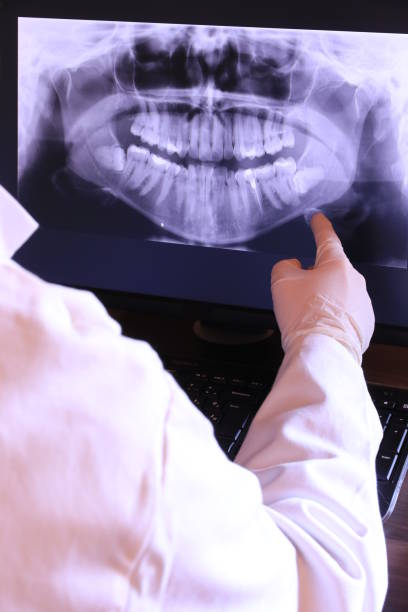 Best Dentist for Tooth Abscess  in Springmont, PA