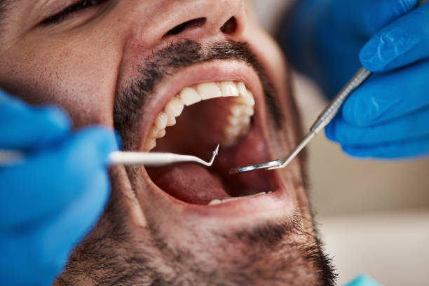 Best Urgent Tooth Repair  in Springmont, PA